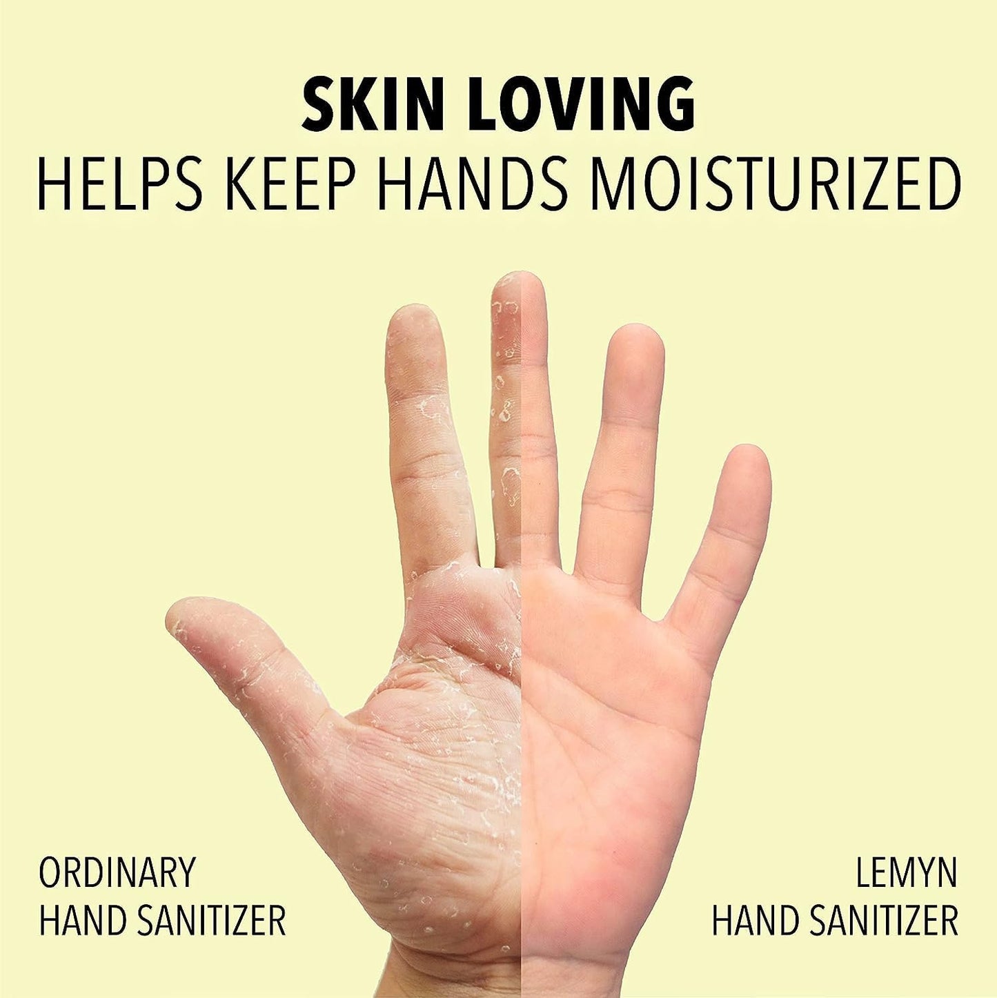 Medical Grade Hand Sanitizer Gel - 97% ORGANIC - 8 FL.OZ. Flip-Top (PACK OF 12)